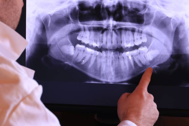Best Pediatric Emergency Dentist in Langley, SC