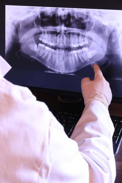 Best Emergency Wisdom Teeth Removal in Langley, SC